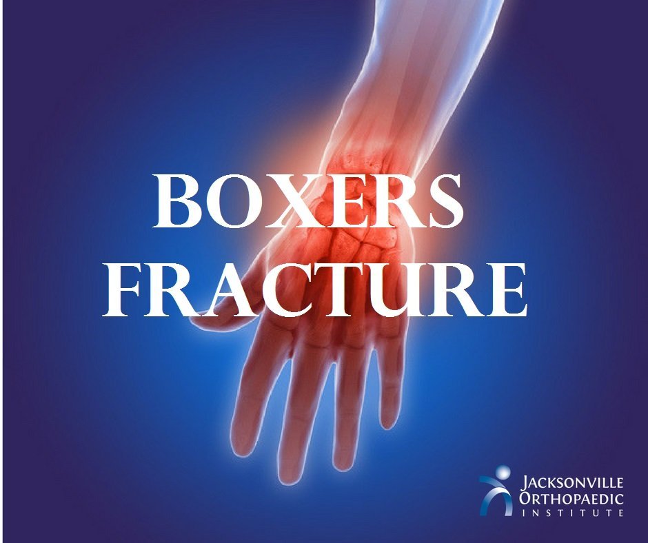 Hands Hurt After Boxing Training at Gail Cramer blog