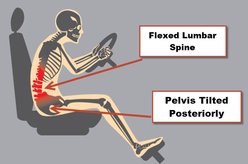 Best Driving Position For Lower Back Pain – RASD