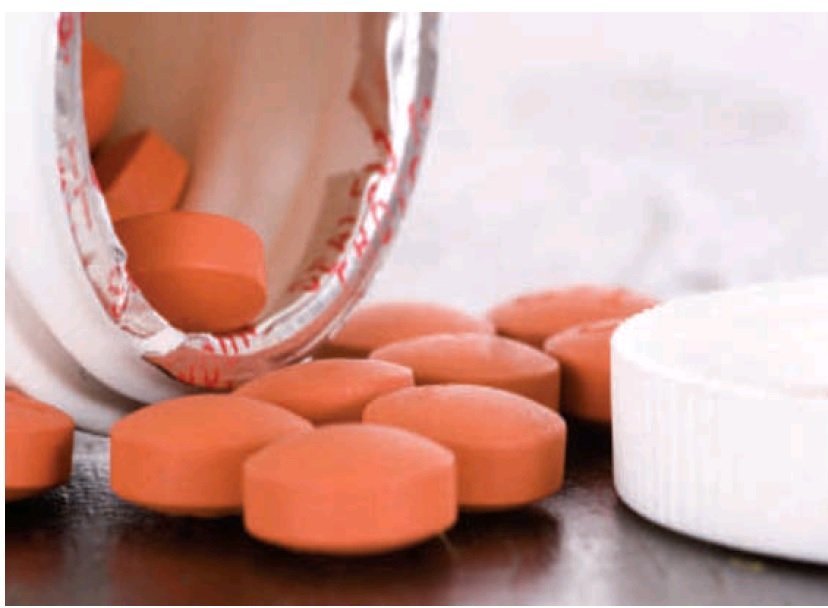 Over the Counter Medications and Physical Therapy